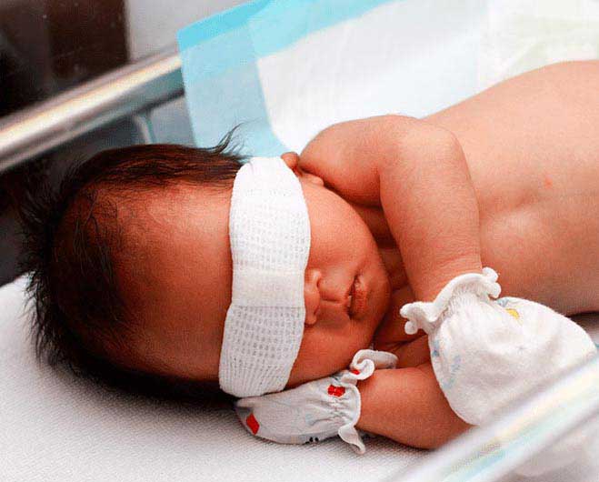 کودک تحت درمان زردی-نمایی دیگر-مدت زمان استفاده-مقاله