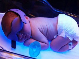 همه چیز در مورد زردی نوزاد 